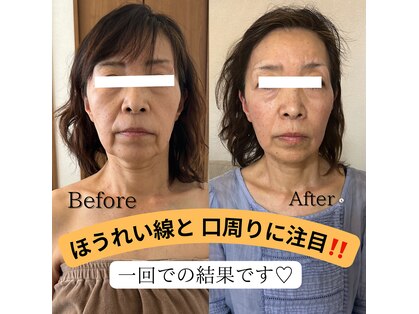 シュクレールの写真