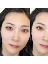 リル 丸の内店(Rill)/【アンドヘルシー】100本