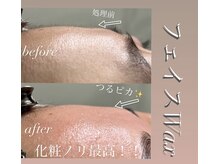 キュティル(Cutil)/フェイスWaxビフォーアフター