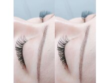 エネル バイ アルト(eneru by arto)/持続性No.1　バインドロック