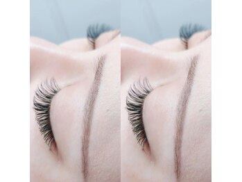 エネル バイ アルト(eneru by arto)/持続性No.1　バインドロック