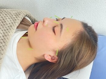 東京鍼灸整骨院の写真/【美白ケアにおすすめ！】お肌にご馳走を♪変われる力を信じ、美肌への一歩を踏み出しましょう◎