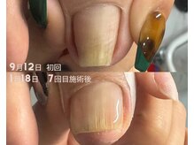 スリーナイン(3Nine)/