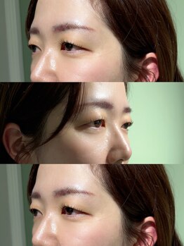 ラーソ(laco)/一重の方も◎　立ち上げカール