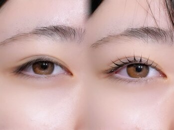 ソナム バイ レンジ(sonam by lange)/beforeafter