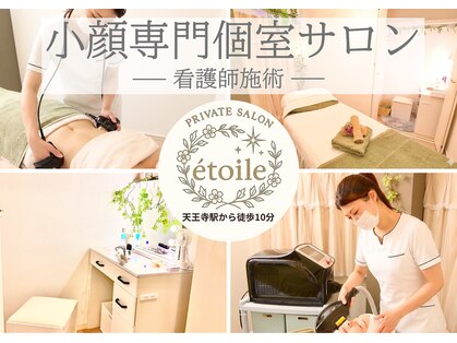 エトワール(etoile)の写真