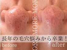 モア 吉祥寺(MORE.)