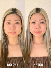 グレースフィオーレ 横浜店(gracefiore)/施術ビフォーアフター