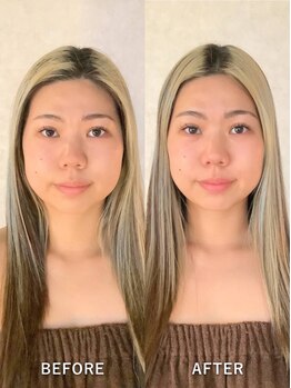 グレースフィオーレ 横浜店(gracefiore)/施術ビフォーアフター