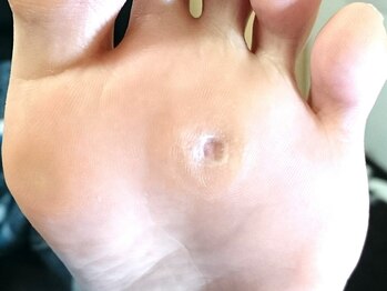 練馬フットケアセンター/◆ドイツ式トータルフットケア☆