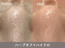 トウメイコガオ 横浜店/トウメイコガオでハーブ