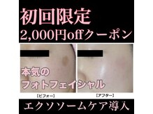 ヤエ