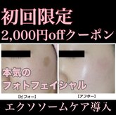 ヤエ