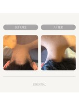 エッセンシャル 南海難波店(ESSENTIAL)/うなじ脱毛￥3,000