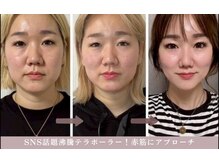 ディオーネ 岡崎店(Dione)