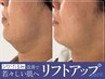 【メンズフェイシャル】　【リフトアップケア】でシワ・たるみの改善へ♪