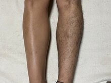 ベリー(BELLY)の雰囲気（太めの毛でも効果絶大◎美肌にもなるような脱毛器を使用！）