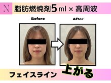 オーク ナチュリ 成城学園前(OAK×NACHUL)/【徹底的結果重視】最新造顔術★