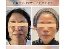 ママニエ(ma maniere)/究極のエイジングケア光フォト