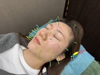 谷塚みんなの鍼灸整骨院の写真/ぼやけたフェイスラインに喝!プロの手技でリフトUP♪しっかりカウンセリングするから初めての方でも安心◎