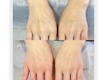 シャルム ド ネイルズ(Charm de nails)/