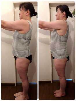 ヨサパーク アカーシャ(YOSA PARK AKASHA)/お腹周りがお悩み