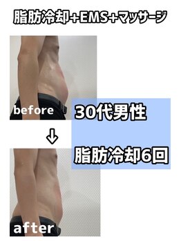 スリム(SLIM by lily of the valley)/お腹