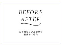 ニキビケア研究所 池袋店/BEFORE AFTER