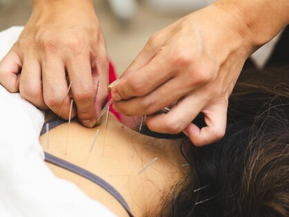 マリカ鍼灸接骨院の写真