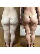 スリール(sourire)/ビフォーアフター