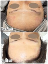 ニュイ(nuit)/グロスピール1回目