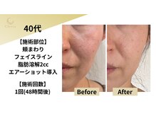 クレビア(Clevia)/Clevia-クレビア-