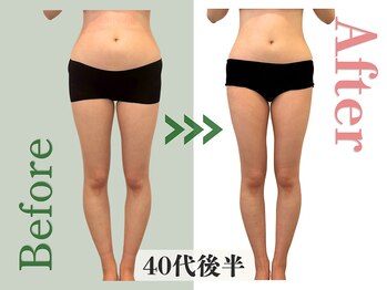 アムール(Amour)/反り腰、Ｏ脚悩み｜30代女性