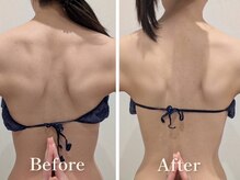 セルノヴァ(Cell Nova)の雰囲気（最新ウィンバック痩身で脂肪深部にケアしボディラインを整える◇）