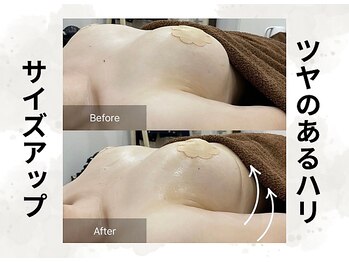 ボニービューティー(Bony Beauty)/BeforeAfter【4】