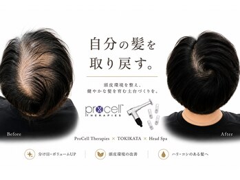 スパ 香炉の写真/【結果重視の肌質改善頭皮ケア】抜け毛、M字、産後あらゆる髪のお悩みに肌も髪も育てる