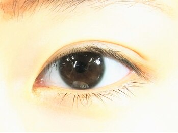 アイズ 深谷店(I's)/ビフォー施術前