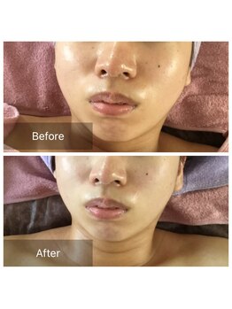 ボディメイクサロンアプローズ/フェイシャルメニュー