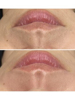 ホワイトワックス 京都四条烏丸(WHITE WAX)/《全顔》フェイシャルワックス