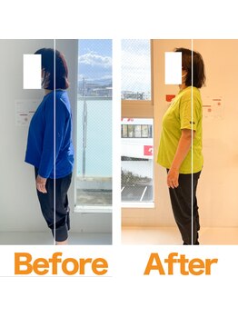 整体院ひなた 都城院/坐骨の痛みと歩行時の腰痛改善!!