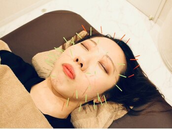 クマノミ美容鍼灸 北浦和院(KUMANOMI美容鍼灸)/ホウレイ線もケア♪