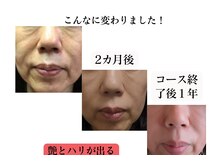 フェイシャルサロン セレスタイトの雰囲気（AI肌診断機で原因を科学的に分析！【たるみ】や【毛穴】をケア◎）