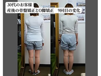 ベルフィオーレ/産後の骨盤矯正とO脚矯正