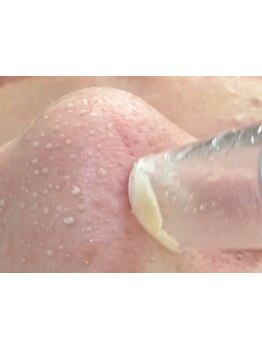 毛穴ケアをしたい