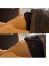 ミリム(milim)/【バストアップ/育乳】症例