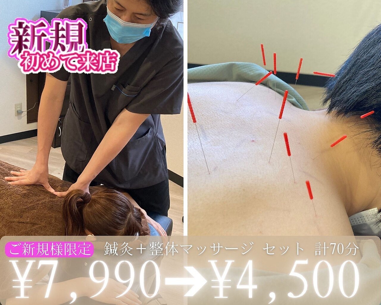【慢性】鍼灸＋マッサージ 慢性肩こり/頭痛改善セット 計70分★ \7990→\4500