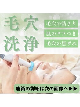 ルーセント/
