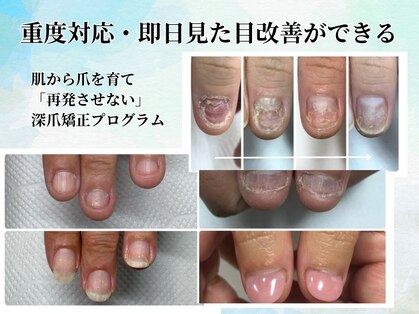 ブルームーンネイルズ(BLOOMOON.nails)の写真