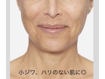 トータルエステ ユキ(YUKI)の写真