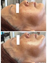 private salon Ponola【ポノーラ】/カーボキシー